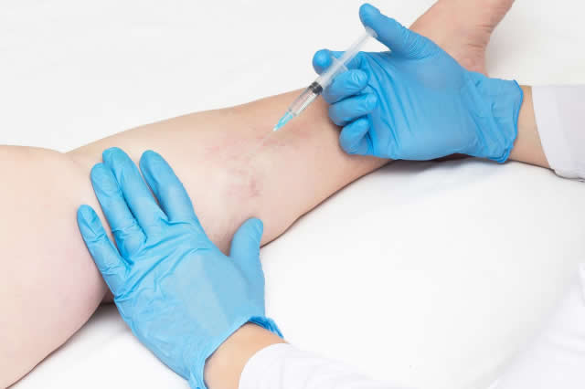 ESPECIALISTA EN VARICES QUITO